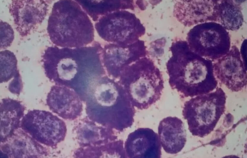 картинка масцитомы